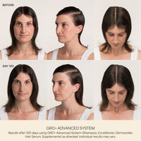 GRO+ Advanced Hair Serum
