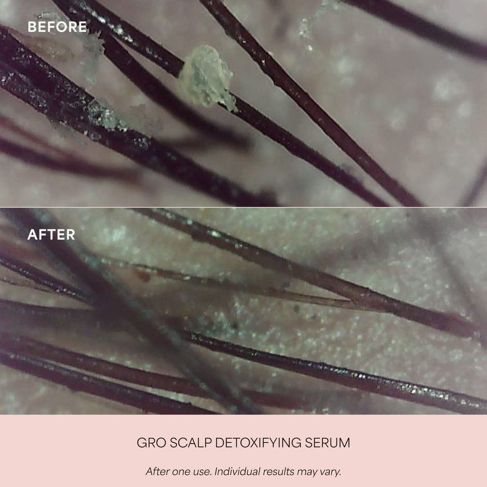 GRO Scalp Detoxifying Serum