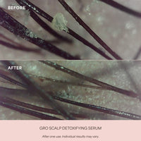 GRO Scalp Detoxifying Serum