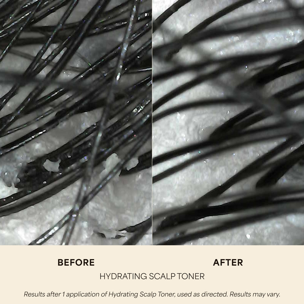 Hydrating Scalp Toner