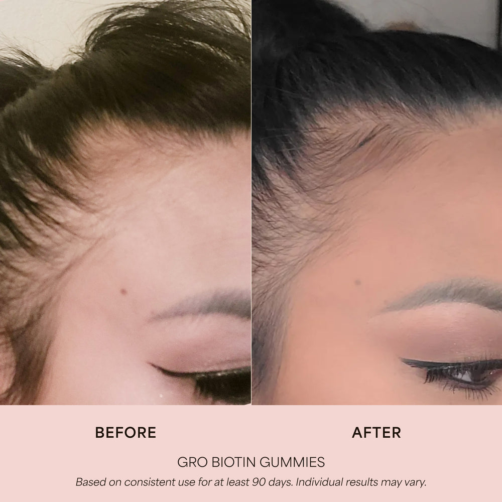 GRO Biotin Gummies for Hair Wellness® (3 Pack)