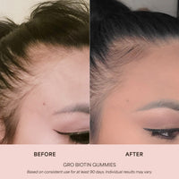 GRO Biotin Gummies for Hair Wellness®
