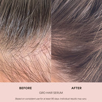 GRO Hair Serum