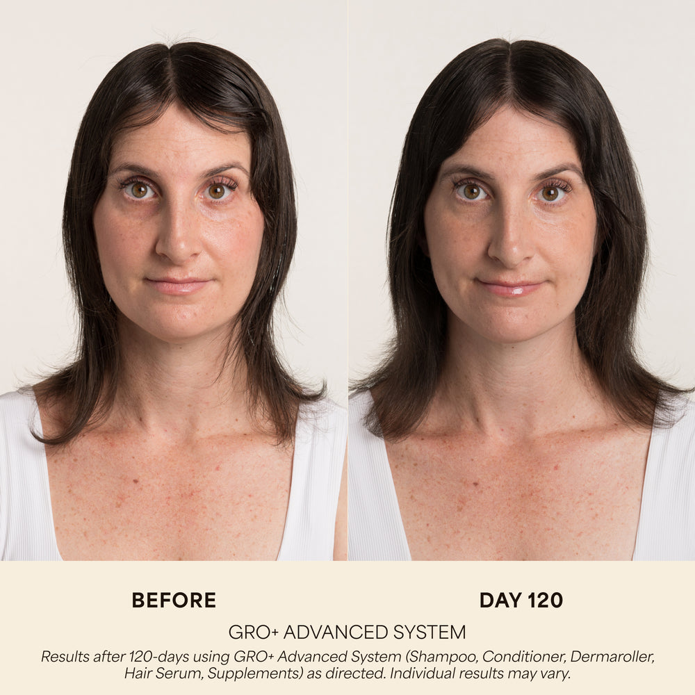 GRO+ Advanced Balancing Conditioner