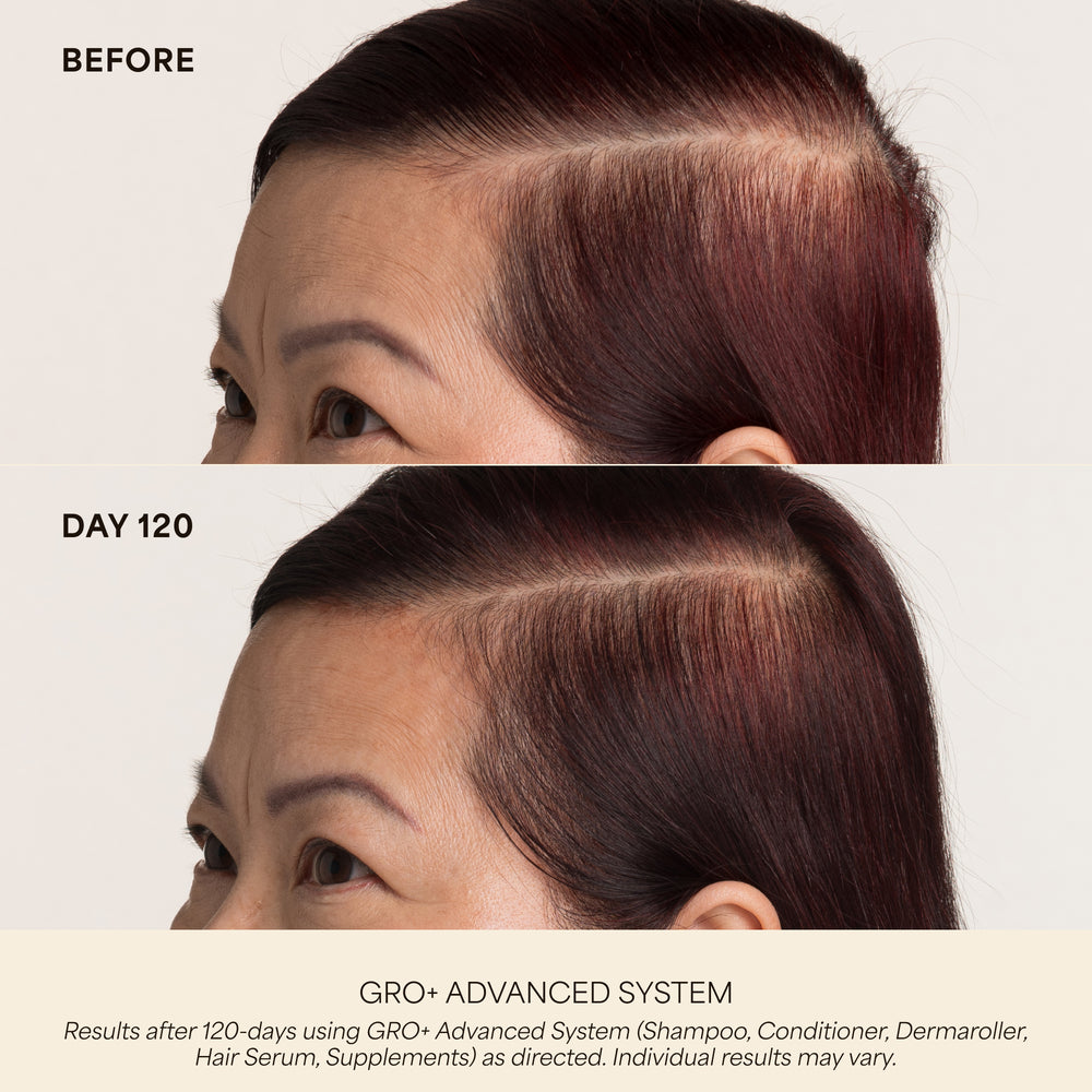 GRO+ Advanced Hair Serum