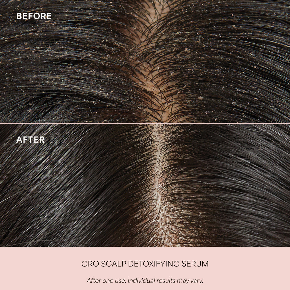 GRO Scalp Detoxifying Serum