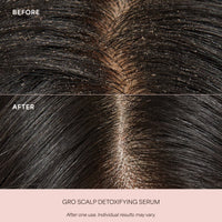 GRO Scalp Detoxifying Serum