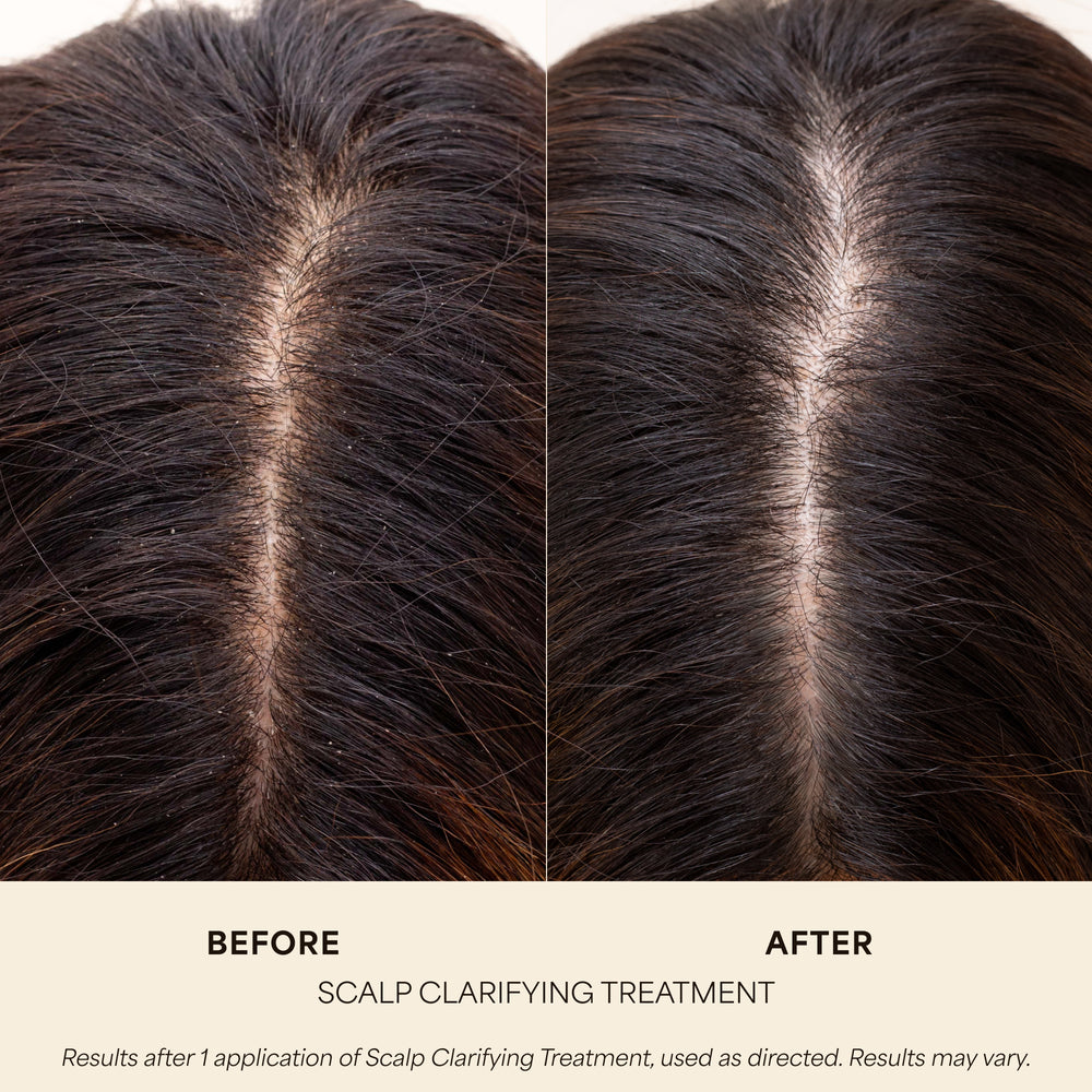 Scalp Clarifying Treatment