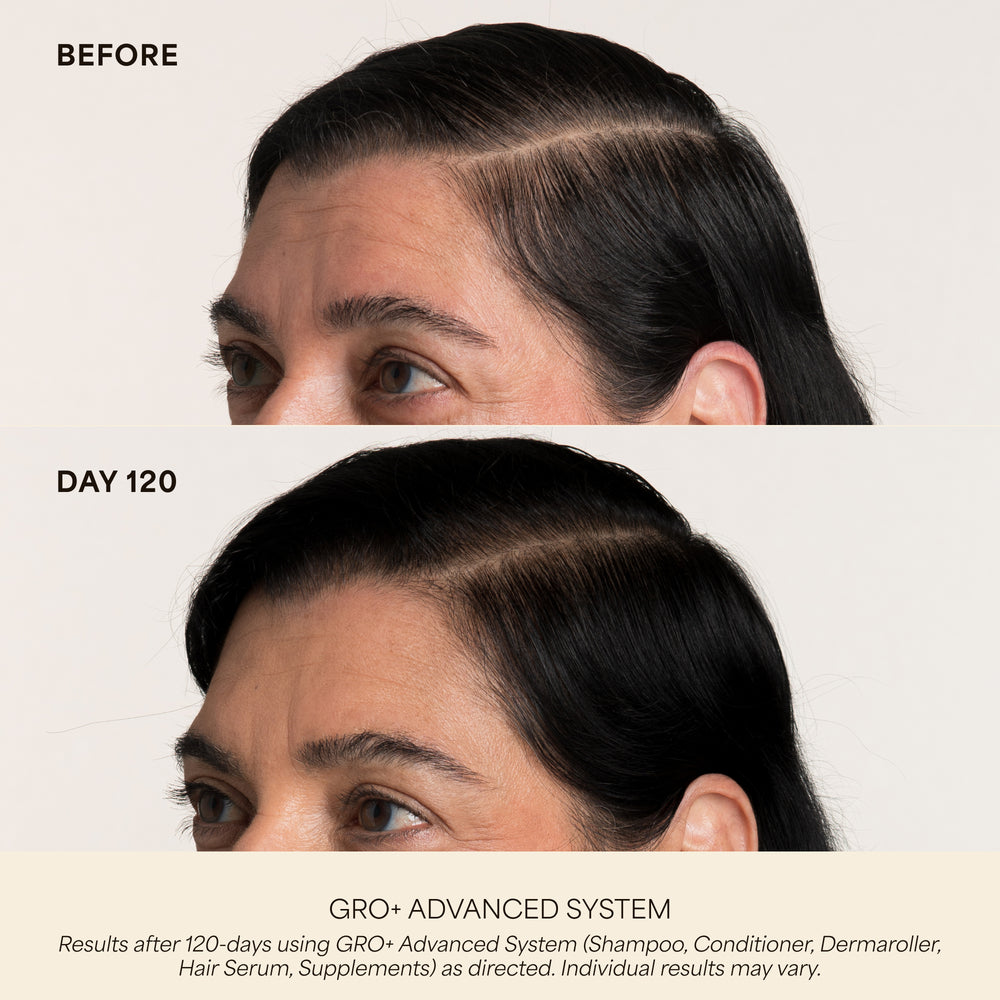 GRO+ Advanced Hair Serum