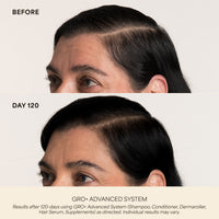 GRO+ Advanced Hair Serum