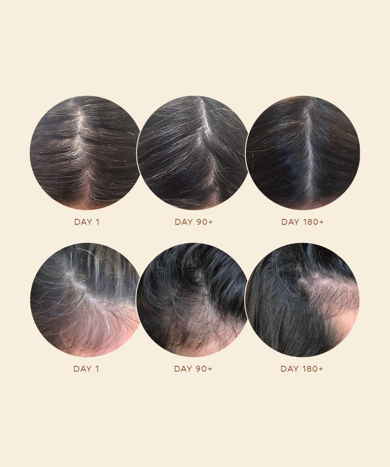 Buy BODYTALES AntiGrey Hair Serum  Arcolys  Melanogray  Redensyl   Hairline  Reduce PreMature Hair Greying  Prevents further Greying   Paraben Free  Hair Growth Serum for Men 
